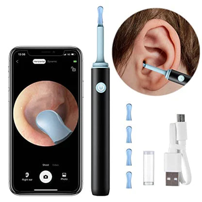 CYNTRIX™   - PROFESSIONAL EAR WAX REMOVAL TOOL